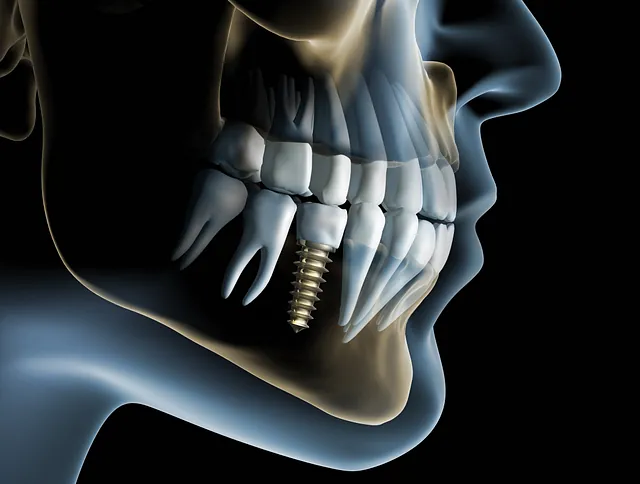 tratamientos dentales